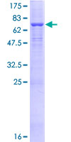 ATP6AP1 Protein - 12.5% SDS-PAGE of human ATP6AP1 stained with Coomassie Blue
