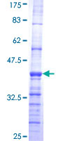 ATP6AP1 Protein - 12.5% SDS-PAGE Stained with Coomassie Blue.