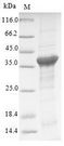 ATP6AP2 / Renin Receptor Protein - (Tris-Glycine gel) Discontinuous SDS-PAGE (reduced) with 5% enrichment gel and 15% separation gel.