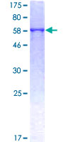 ATP6AP2 / Renin Receptor Protein - 12.5% SDS-PAGE of human ATP6AP2 stained with Coomassie Blue