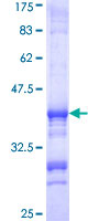 ATP6E / ATP6V1E1 Protein - 12.5% SDS-PAGE Stained with Coomassie Blue.