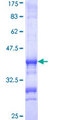 ATP6E / ATP6V1E1 Protein - 12.5% SDS-PAGE Stained with Coomassie Blue.