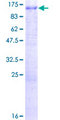 ATP6V0A1 Protein - 12.5% SDS-PAGE of human ATP6V0A1 stained with Coomassie Blue