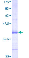 ATP6V0A1 Protein - 12.5% SDS-PAGE Stained with Coomassie Blue.