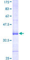 ATP6V0A1 Protein - 12.5% SDS-PAGE Stained with Coomassie Blue.