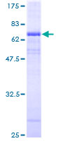 ATP6V0A2 Protein - 12.5% SDS-PAGE of human ATP6V0A2 stained with Coomassie Blue