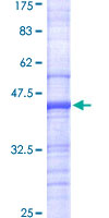 ATP6V0A2 Protein - 12.5% SDS-PAGE Stained with Coomassie Blue.