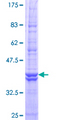 ATP6V0C / VATL Protein - 12.5% SDS-PAGE of human ATP6V0C stained with Coomassie Blue