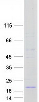 ATP6V0C / VATL Protein - Purified recombinant protein ATP6V0C was analyzed by SDS-PAGE gel and Coomassie Blue Staining