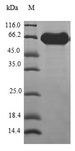 ATP6V0D1 Protein - (Tris-Glycine gel) Discontinuous SDS-PAGE (reduced) with 5% enrichment gel and 15% separation gel.