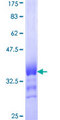 ATP6V0D1 Protein - 12.5% SDS-PAGE Stained with Coomassie Blue.