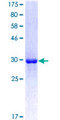 ATP6V0D2 Protein - 12.5% SDS-PAGE Stained with Coomassie Blue.