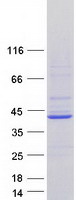ATP6V0D2 Protein - Purified recombinant protein ATP6V0D2 was analyzed by SDS-PAGE gel and Coomassie Blue Staining