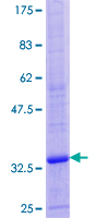 ATP6V0E1 Protein - 12.5% SDS-PAGE of human ATP6V0E stained with Coomassie Blue