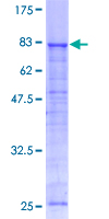 ATP6V1A1 / ATP6V1A Protein - 12.5% SDS-PAGE of human ATP6V1A stained with Coomassie Blue