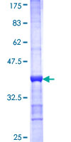 ATP6V1A1 / ATP6V1A Protein - 12.5% SDS-PAGE Stained with Coomassie Blue.