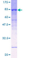ATP6V1B1 Protein - 12.5% SDS-PAGE of human ATP6V1B1 stained with Coomassie Blue