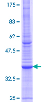 ATP6V1B1 Protein - 12.5% SDS-PAGE Stained with Coomassie Blue.