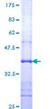 ATP6V1C1 Protein - 12.5% SDS-PAGE Stained with Coomassie Blue.