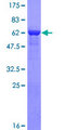 ATP6V1C2 Protein - 12.5% SDS-PAGE of human ATP6V1C2 stained with Coomassie Blue