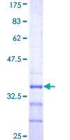 ATP6V1E2 Protein - 12.5% SDS-PAGE Stained with Coomassie Blue.