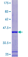 ATP6V1F Protein - 12.5% SDS-PAGE of human ATP6V1F stained with Coomassie Blue