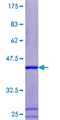 ATP6V1F Protein - 12.5% SDS-PAGE of human ATP6V1F stained with Coomassie Blue