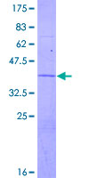 ATP6V1G2 Protein - 12.5% SDS-PAGE of human ATP6V1G2 stained with Coomassie Blue