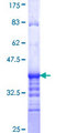 ATP6V1G2 Protein - 12.5% SDS-PAGE Stained with Coomassie Blue.