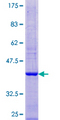 ATP6V1G3 Protein - 12.5% SDS-PAGE of human ATP6V1G3 stained with Coomassie Blue