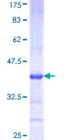 ATP6V1G3 Protein - 12.5% SDS-PAGE Stained with Coomassie Blue.