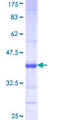 ATP6V1G3 Protein - 12.5% SDS-PAGE Stained with Coomassie Blue.