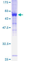 ATP6V1H Protein - 12.5% SDS-PAGE of human ATP6V1H stained with Coomassie Blue