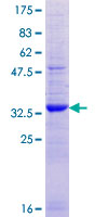 ATP8B1 / BRIC Protein - 12.5% SDS-PAGE Stained with Coomassie Blue.