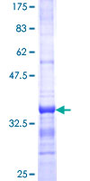 ATP8B2 Protein - 12.5% SDS-PAGE Stained with Coomassie Blue.