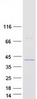 ATP8B2 Protein - Purified recombinant protein ATP8B2 was analyzed by SDS-PAGE gel and Coomassie Blue Staining