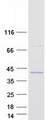 ATP8B2 Protein - Purified recombinant protein ATP8B2 was analyzed by SDS-PAGE gel and Coomassie Blue Staining