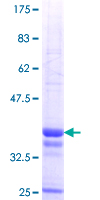 ATP8B4 Protein - 12.5% SDS-PAGE Stained with Coomassie Blue.