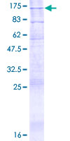 ATP9A Protein - 12.5% SDS-PAGE of human ATP9A stained with Coomassie Blue