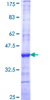ATP9A Protein - 12.5% SDS-PAGE Stained with Coomassie Blue.