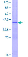ATP9B Protein - 12.5% SDS-PAGE of human ATP9B stained with Coomassie Blue