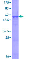 ATPAF2 Protein - 12.5% SDS-PAGE of human ATPAF2 stained with Coomassie Blue