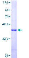 ATPIF1 / ATPI Protein - 12.5% SDS-PAGE of human ATPIF1 stained with Coomassie Blue