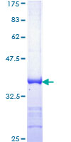 ATR Protein - 12.5% SDS-PAGE Stained with Coomassie Blue.