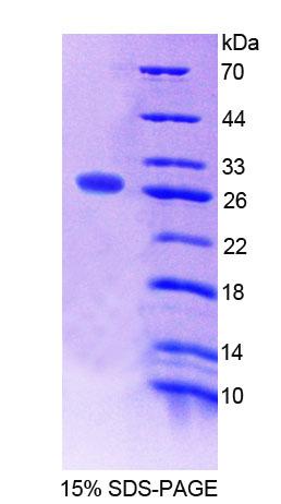 ATR Protein - Recombinant Antitrypsin Related Protein (ATR) by SDS-PAGE