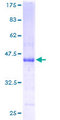 ATRAID / C2orf28 Protein - 12.5% SDS-PAGE of human C2orf28 stained with Coomassie Blue