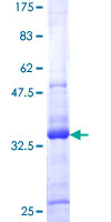 ATRX Protein - 12.5% SDS-PAGE of human ATRX stained with Coomassie Blue