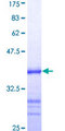ATRX Protein - 12.5% SDS-PAGE Stained with Coomassie Blue.