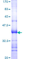 ATXN1 / SCA1 Protein - 12.5% SDS-PAGE Stained with Coomassie Blue.