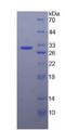 ATXN1 / SCA1 Protein - Recombinant Ataxin 1 By SDS-PAGE